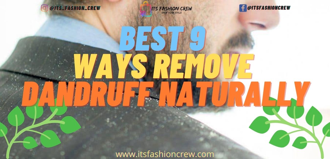Best 9 Ways To Remove Dandruff Naturally